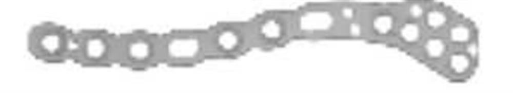 Produktbild - VF000192585 - Superior Lateral Plate VariAx Clavicle  7 Hole / Left