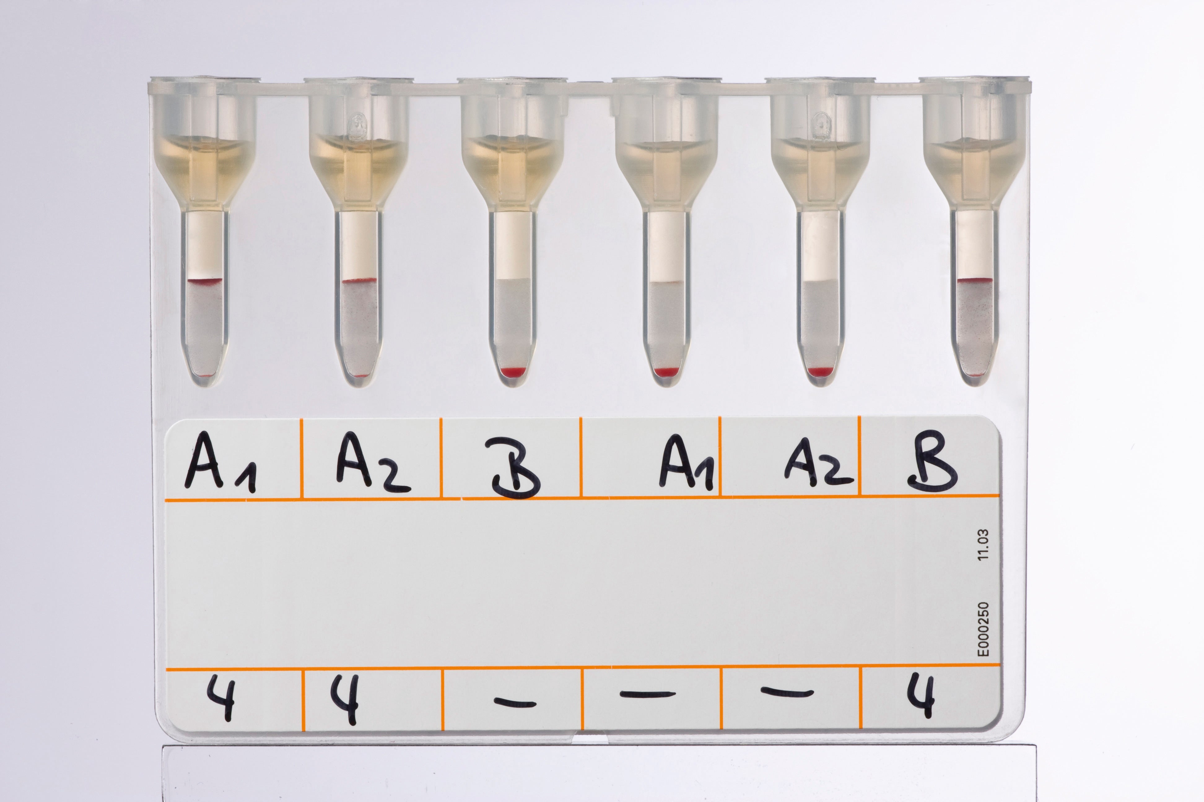 Produktbild - VF000078403 - Antikroppsidentifiering med NaCl/Enzym och Coombs Anti-IgG