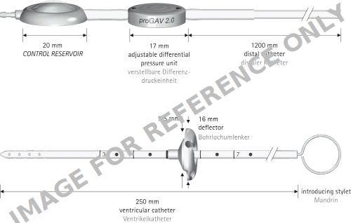 Produktbild - VF7004662 - Progav 2.0 System With Control Reservoir