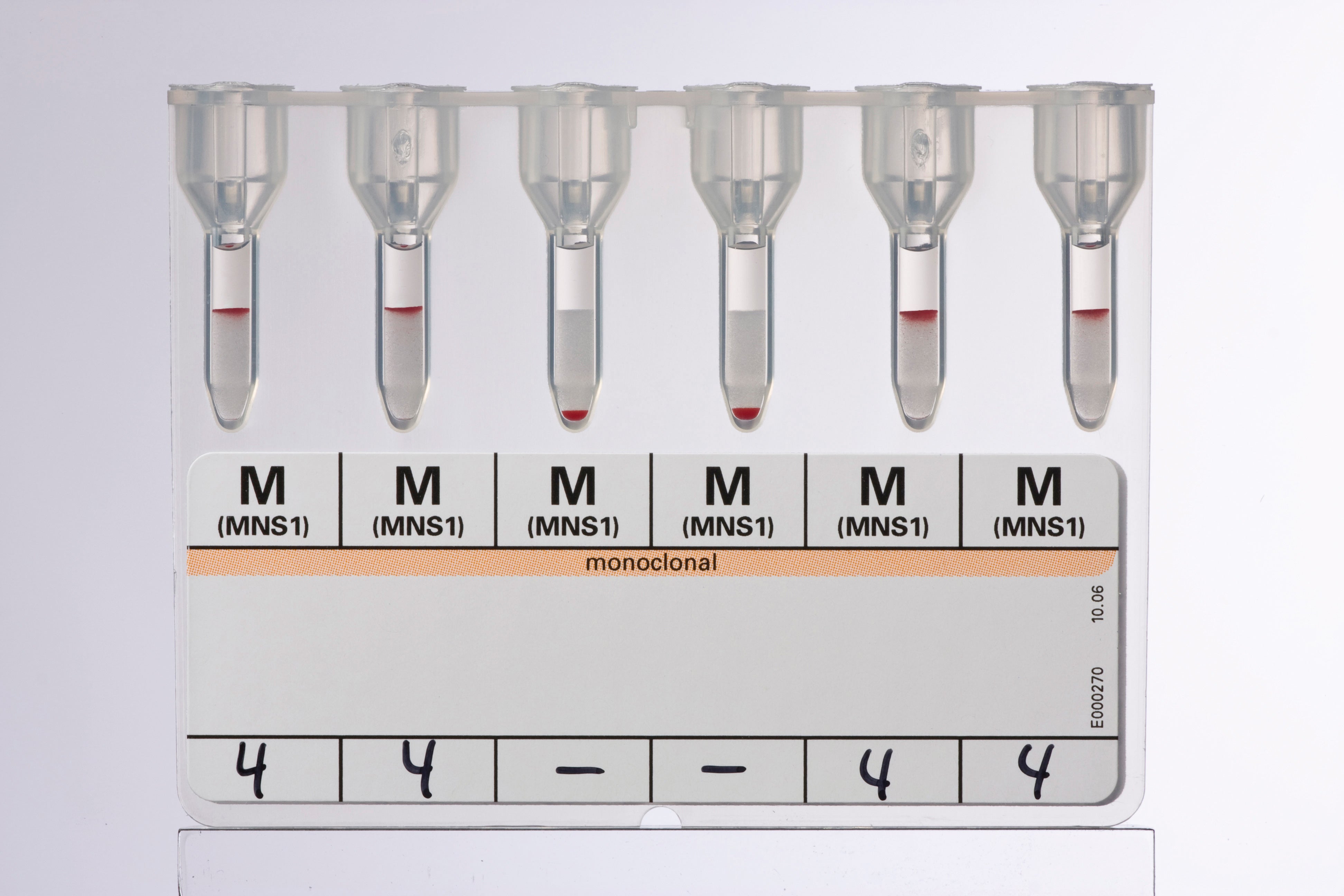 Produktbild - VF000078407 - Reagens Anti-M för fenotypning