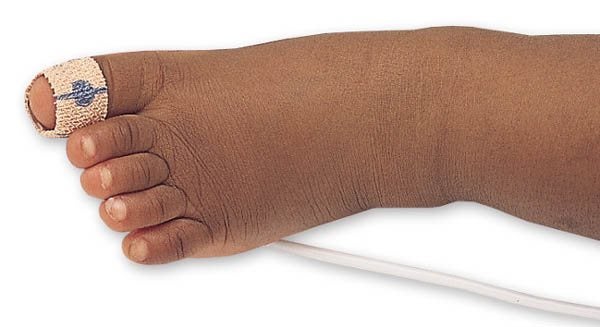Produktbild - 84382 - Pulsoximeterprob för tå självhäftande enpatientbruk 3-20kg