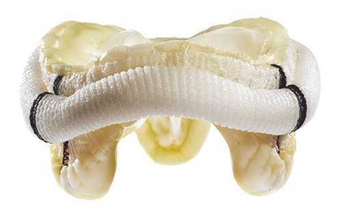 Produktbild - VF000184838 - Hjärtklaff mitral biologisk 25mm