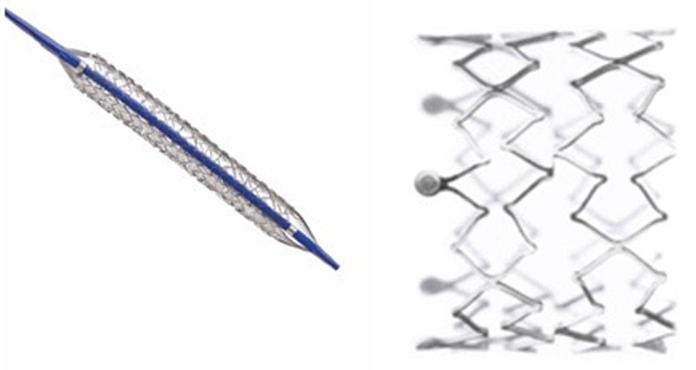 Produktbild - VF000159002 - Stent bäckenartär ballongexpanderande 0.035" Visi-Pro 7Fr 10x57mm 135cm