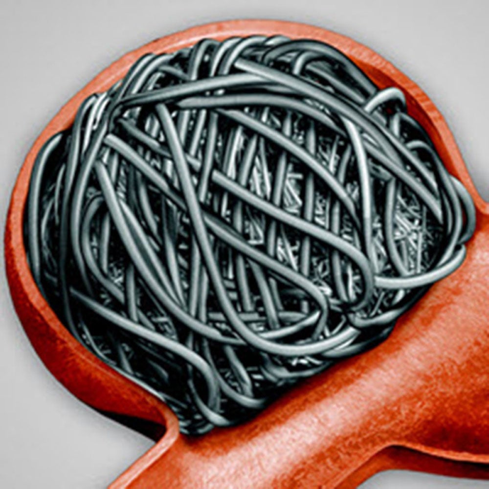 Produktbild - VF000163335 - Intrakraniell coil Prime 3D extra soft 1,5x20mm