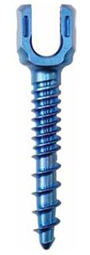 Produktbild - VF000172997 - SOLERA 5.5/6.0 FAS SKRUV TI - 7.5 X 35MM