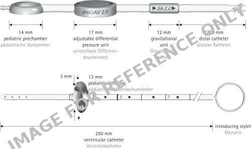 Produktbild - VF7004674 - Progav 2.0 Sys Sa2.0 15 & Ped.Prechamber