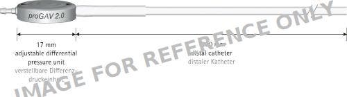 Produktbild - VF7004660 - Progav 2.0 With Distal Catheter