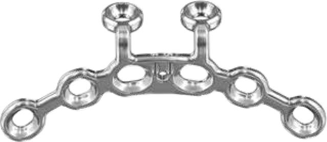 Produktbild - VF000190372 - Symfysplatta 4-6 hål