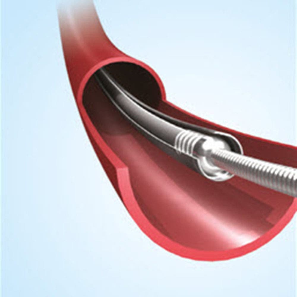 Produktbild - VF000164872 - Mikrokateter med 1 röntgenmarkör i spetsen Marksman 0.027" 150cm