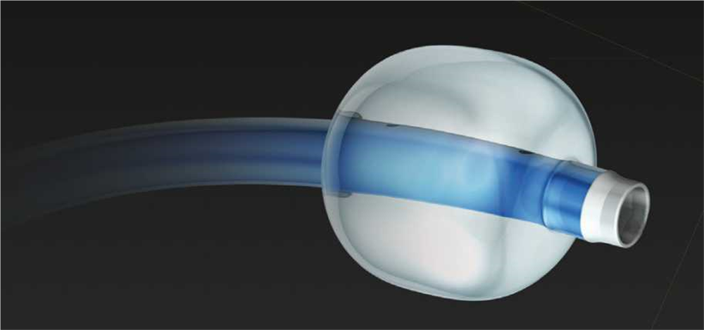 Produktbild - VF000165702 - Ballongguidekateter Flowgate2 8Fr 95cm