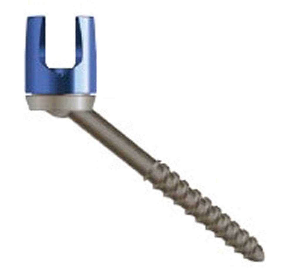 Produktbild - VF000173991 - PARTIAL THREAD MAS G360PT4040 4.0 X 40MM