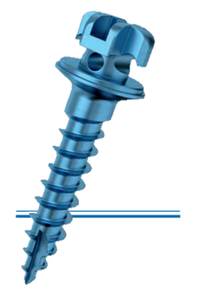 Produktbild - VF000142539 - Miniskruv 1,6x9,5mm