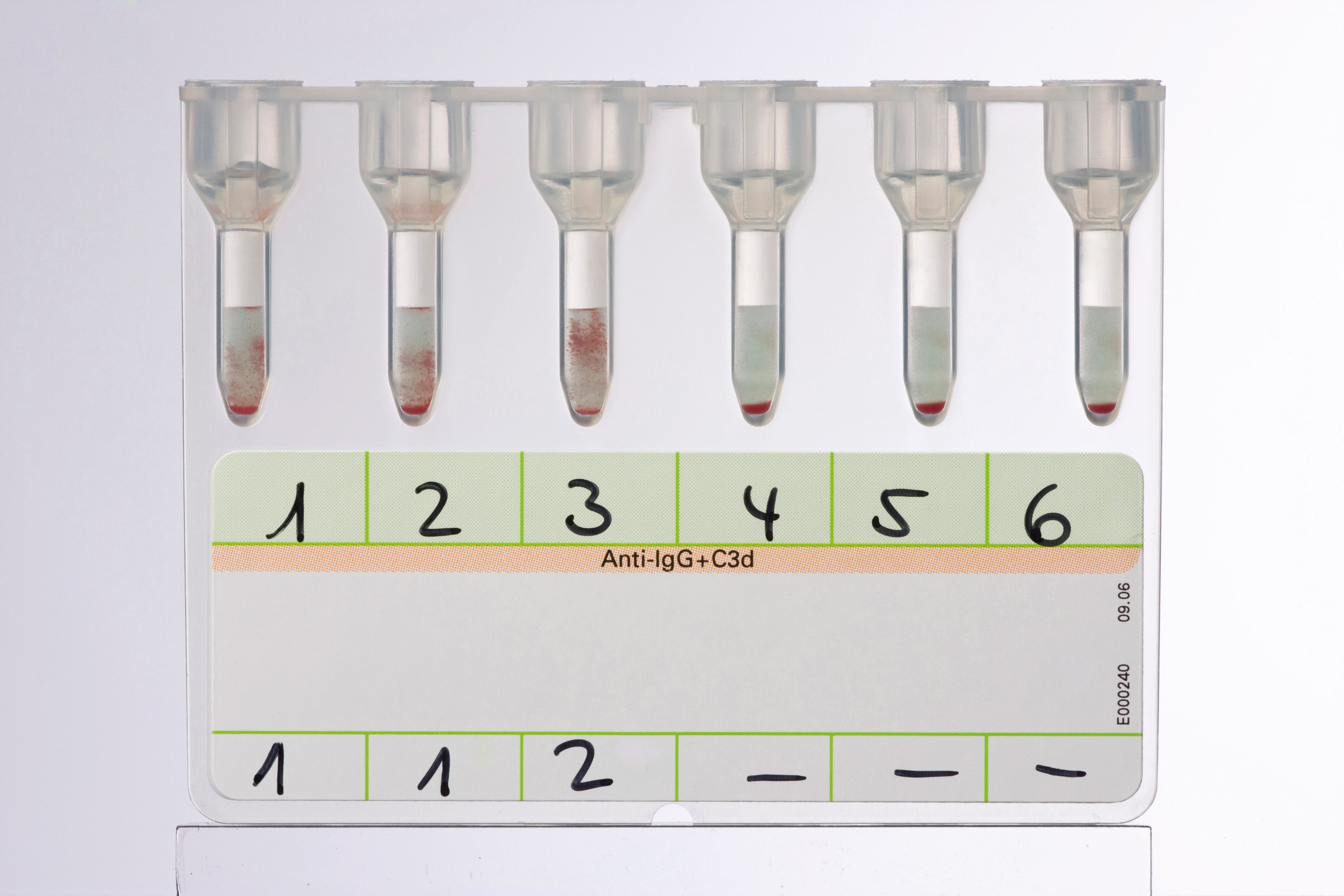 Produktbild - VF000078439 - Direkt antiglobulintest (DAT) LISS/Coombs