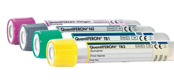 Produktbild - 61131 - Provtagningsset för TBC med 4 rör