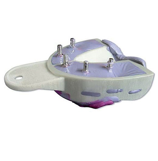 Produktbild - VF000146585 - Avtryckssked för implantat underkäke I3 strl L 6-pack