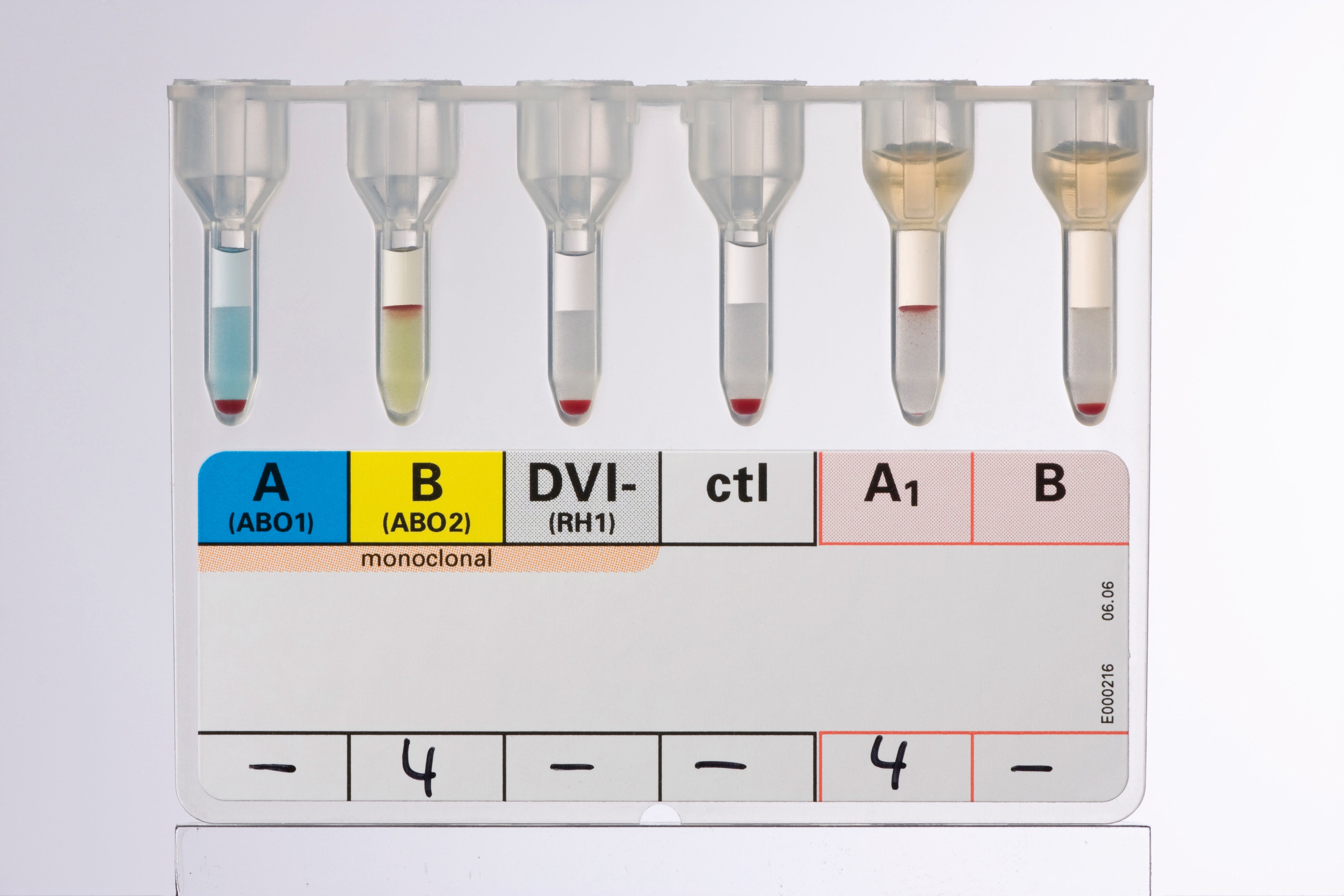 Produktbild - VF000078396 - Blodgruppering ABO/D med reverstest för conf donatorer