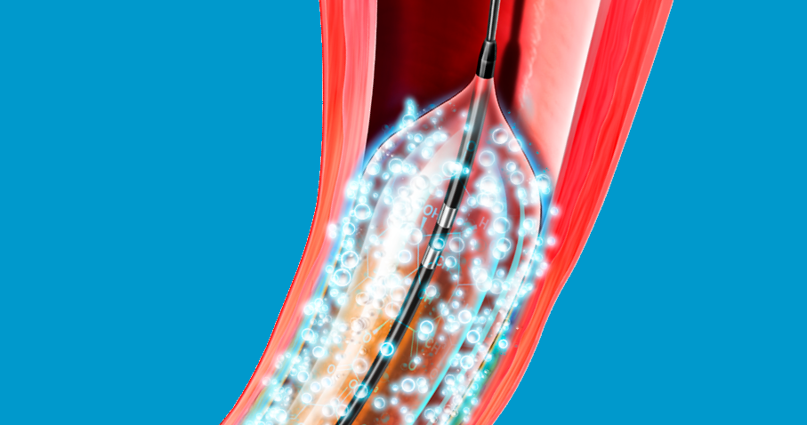 Produktbild - VF000161372 - Läkemedelsballong Lutonix 0.018" 6x40mm 130cm