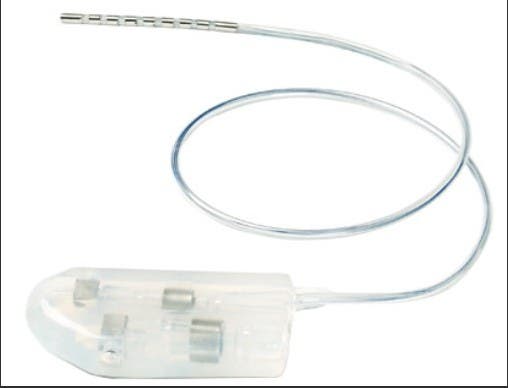 Produktbild - VF000119119 - Pocket Adapter, 25 Cm (Medtronic To Abbott)Is-1