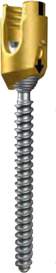 Produktbild - VF000172568 - SKRUV, KANNULERAD, FAVORED ANGLE MEDIAL, Ø 4.0 MM, L26 MM