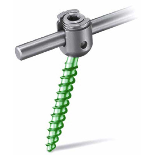 Produktbild - VF000167530 - EXP 4.5 POLY SCREW 4.35 X 25