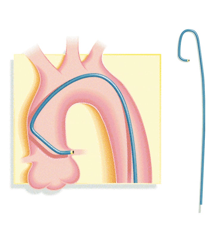 Produktbild - VF000112974 - GUIDEKATETER VISTA BRITE TIP .078 F7 100CM JL-3 SH