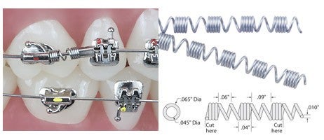 Produktbild - VF000140038 - Skjutande distaliseringsfjäder NiTi för molar