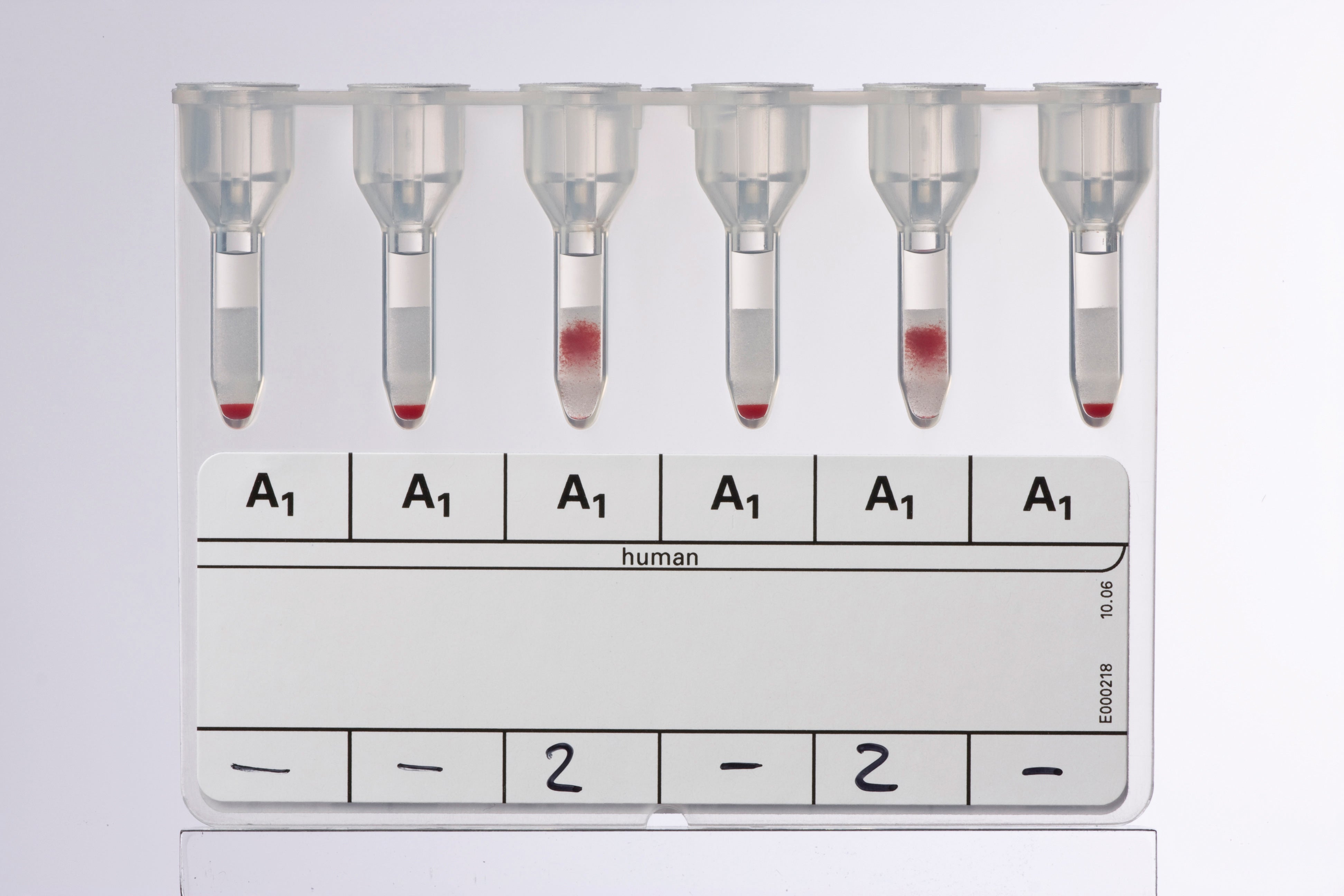 Produktbild - VF000078418 - Anti-A1 reagens absorberad för fenotypning
