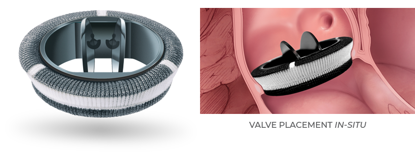 Produktbild - VF000185775 - Hjärtklaff aorta mekanisk 27mm Carbomedics reduced