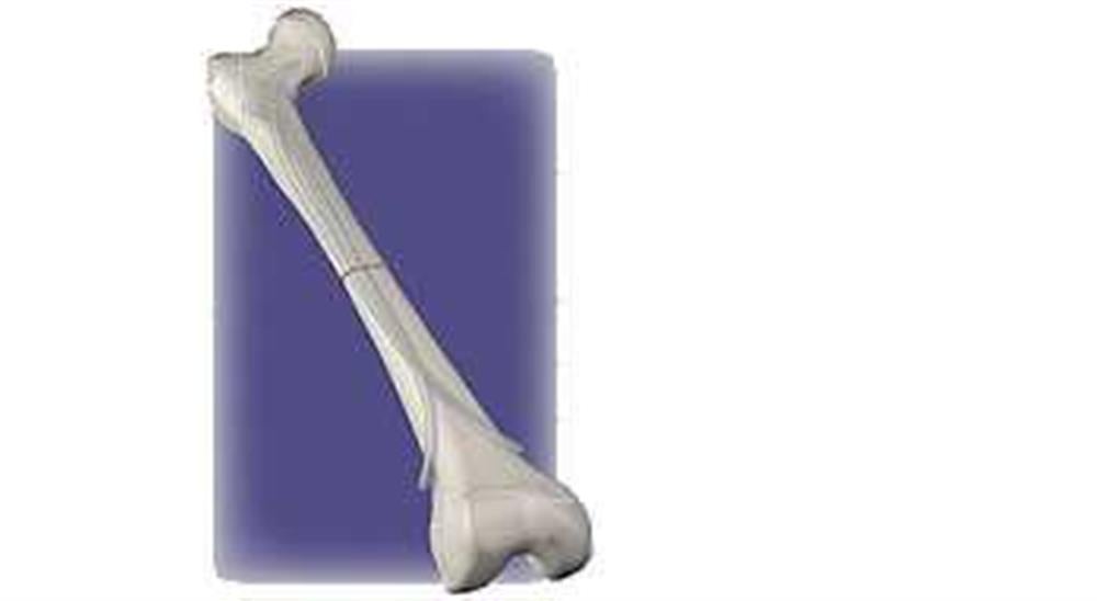 Produktbild - VF000191372 - Flexible Nail, pre-curved T2 Kids Ø1.75x300 mm