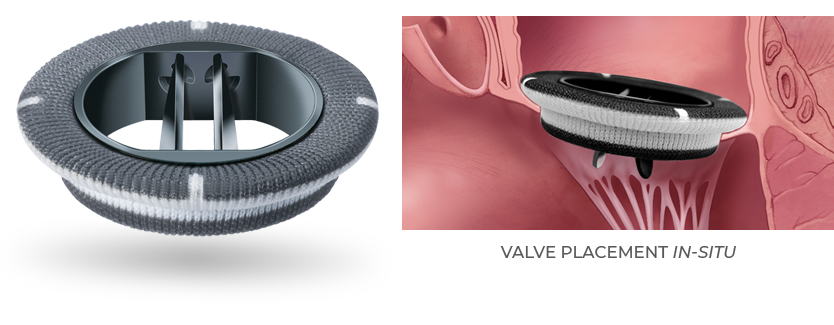 Produktbild - VF000184850 - Hjärtklaff mitral mekanisk 29mm