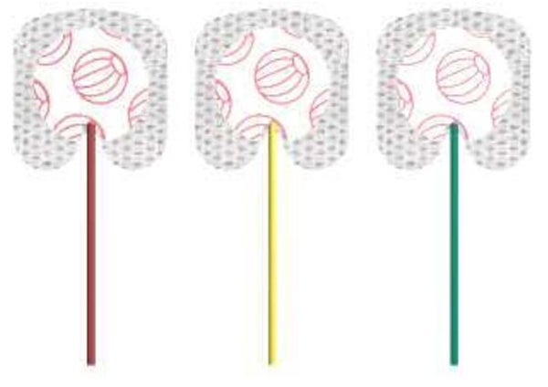 Produktbild - VF000183747 - EKG-elektrod neonatal >1000g med fast gel RTS-slang och DIN-kontakt 50cm