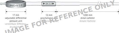 Produktbild - VF7004716 - Progav 2.0 W/Sa2.0 20 & Distal Catheter