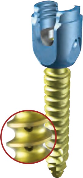 Produktbild - VF000172519 - SKRUV, KANNULERAD, Ø 5.5 MM, L40 MM