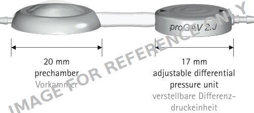 Produktbild - VF7004663 - Progav 2.0 With Prechamber