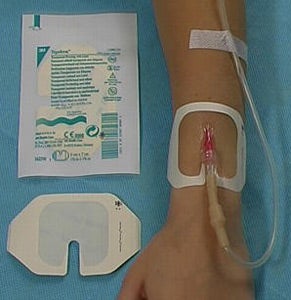 Produktbild - 44802 - Infartsfixering plastfilm med slits till PVK 6x7cm